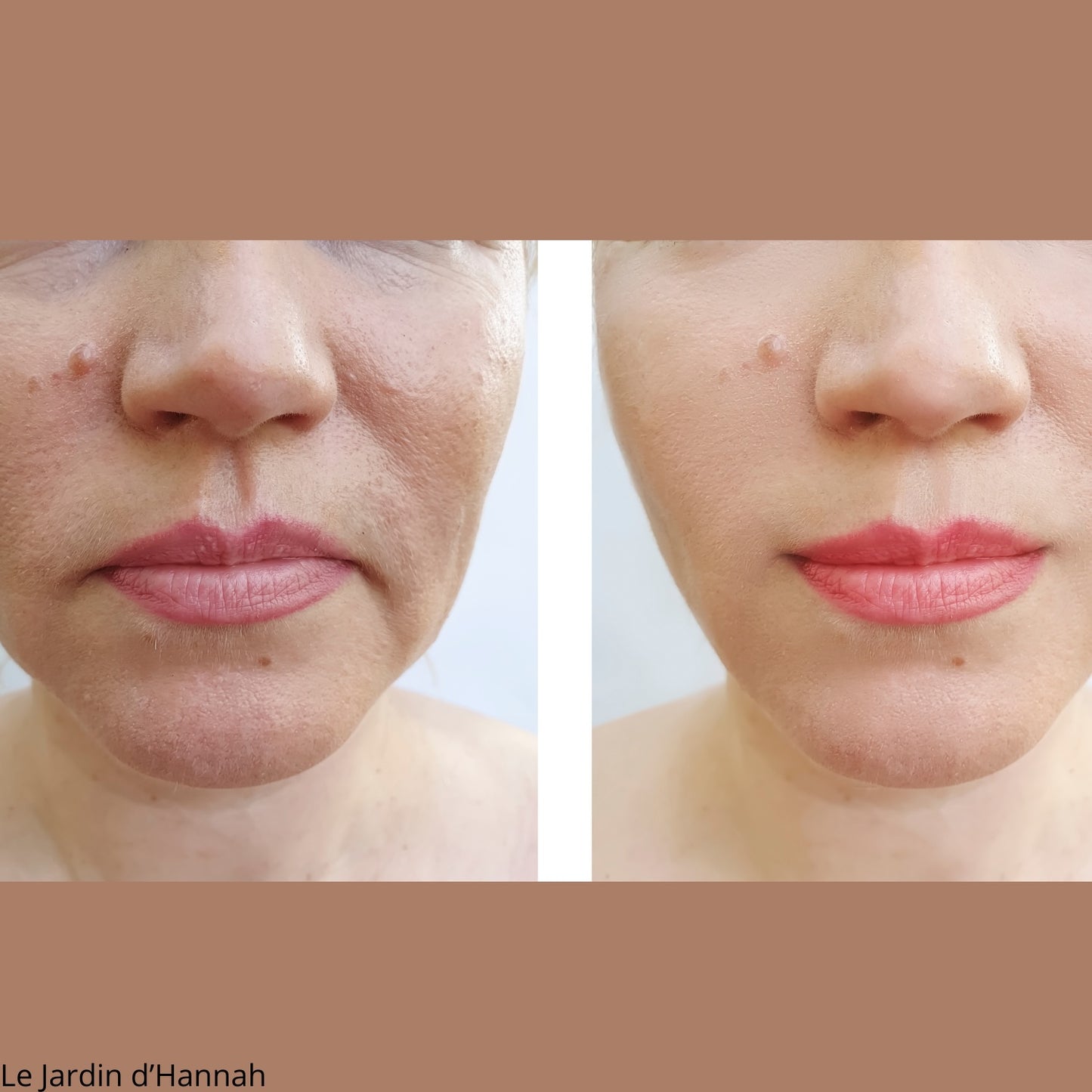 Masque LED - Les soins d'un SPA à la maison