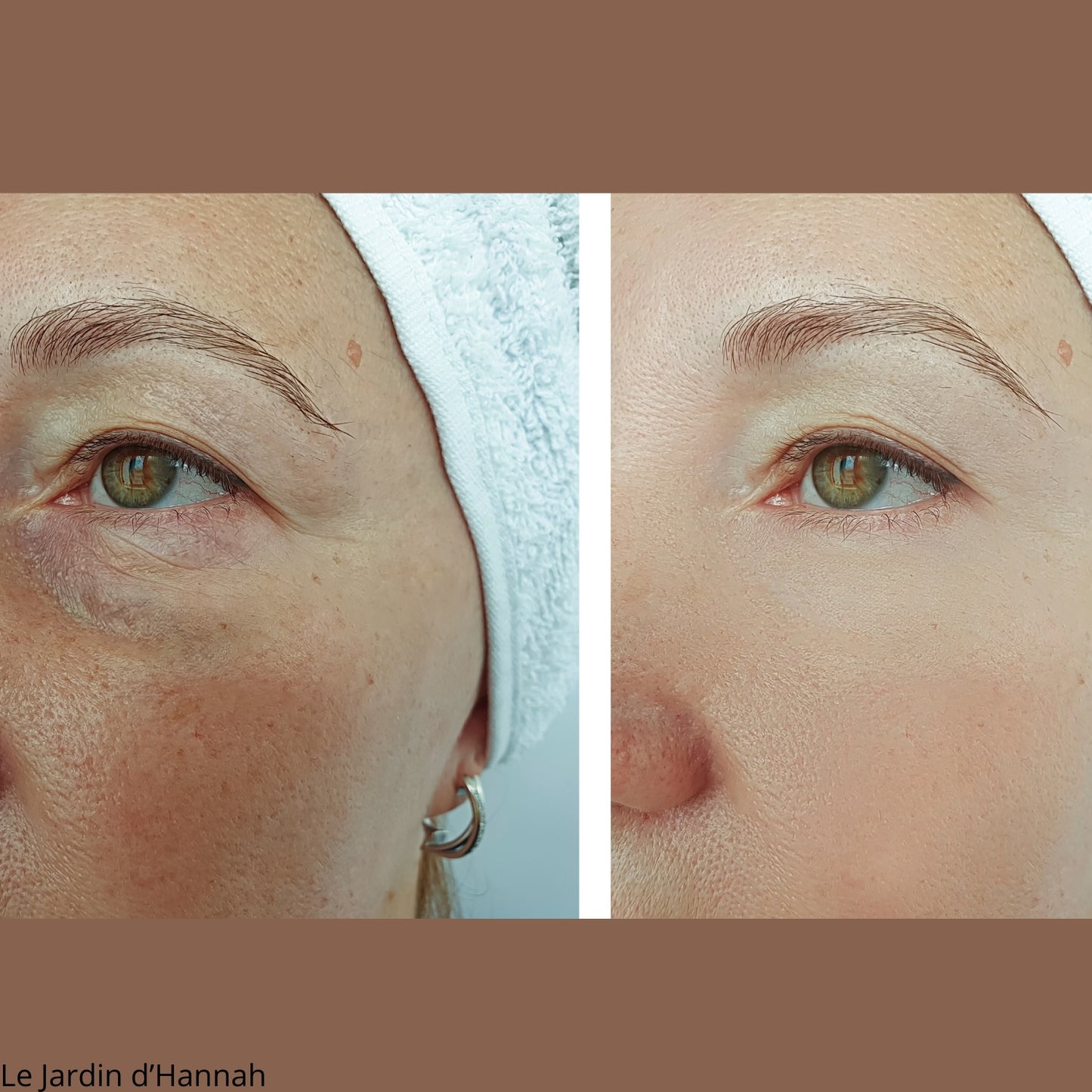 Masque LED - Les soins d'un SPA à la maison